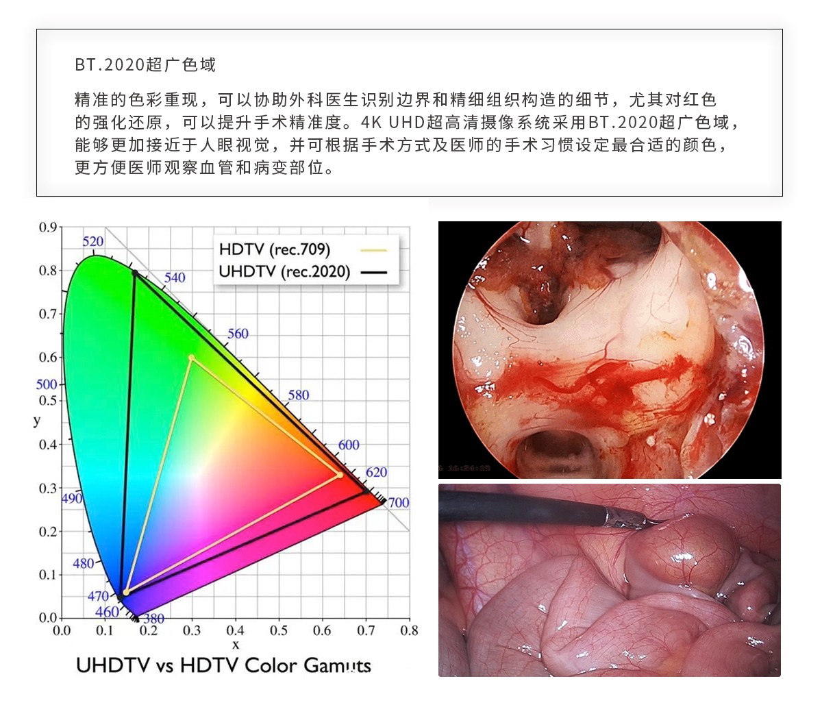 【4K醫(yī)用內(nèi)窺鏡攝像系統(tǒng)】您的第一臺“4K”找到了嗎？