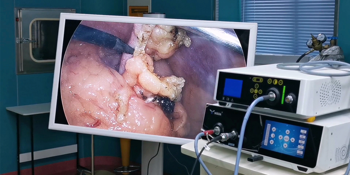 【4K醫(yī)用內(nèi)窺鏡攝像系統(tǒng)】您的第一臺“4K”找到了嗎？