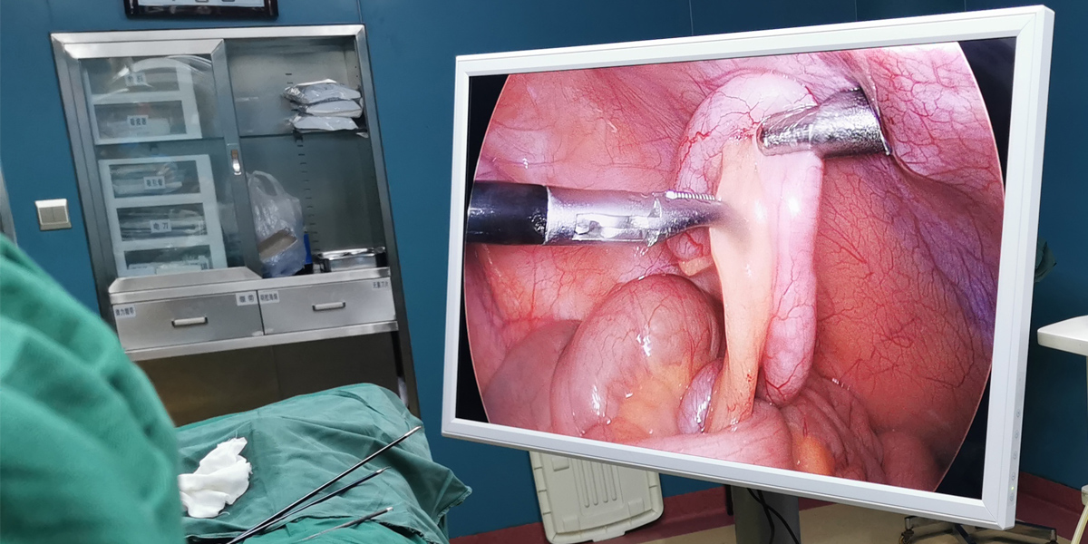 【4K醫(yī)用內(nèi)窺鏡攝像系統(tǒng)】您的第一臺“4K”找到了嗎？