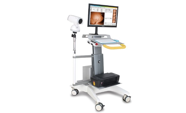 紅外乳腺檢查儀有哪些品牌？