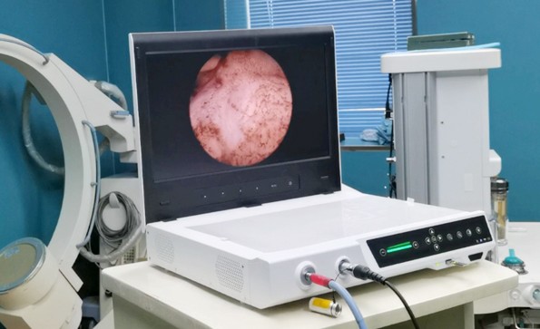 一文了解關(guān)節(jié)鏡系統(tǒng)的構(gòu)成、應(yīng)用、操作流程